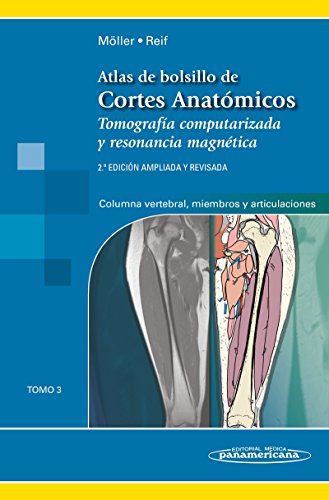 Atlas De bolsillo de Cortes anatómicos (Tomo 3. Tomografía computarizada y resonancia magnética: Columna vertebral, Miembros y Articulaciones)