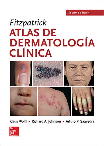 FITZPATRICK ATLAS DE DERMATOLOGIA CLINICA