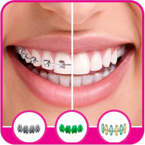 Braces Camera Stickers Photo Editor