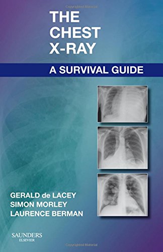 The Chest X-Ray: A Survival Guide, 1e