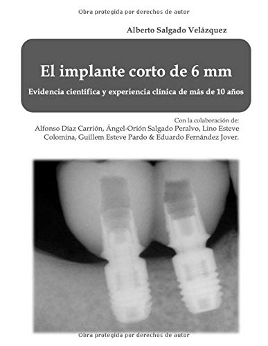 El implante corto de 6 mm: Evidencia científica y experiencia de más de 10 años.