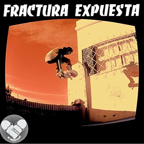 Fractura Expuesta