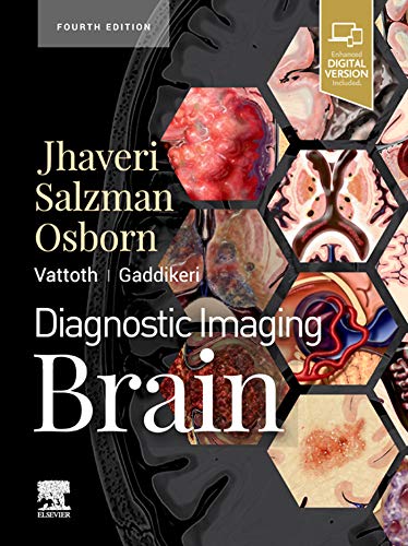 Diagnostic Imaging: Brain E-Book (English Edition)