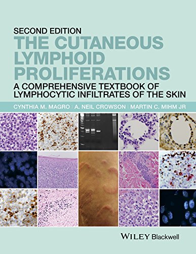 The Cutaneous Lymphoid Proliferations: A Comprehensive Textbook of Lymphocytic Infiltrates of the Skin (English Edition)