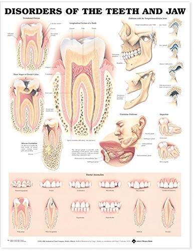 Trastornos de los Dientes y la Mandíbula Tabla Anatómica