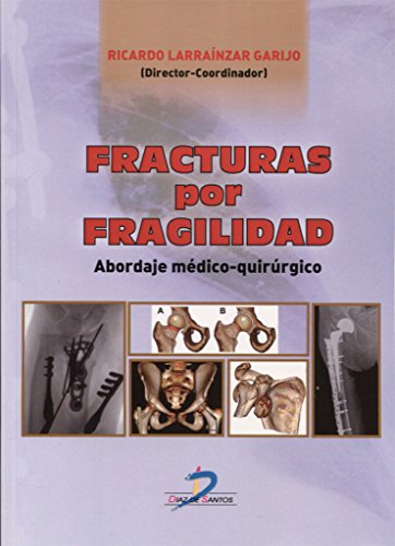 Fracturas por fragilidad: Abordaje médico quirúrgico
