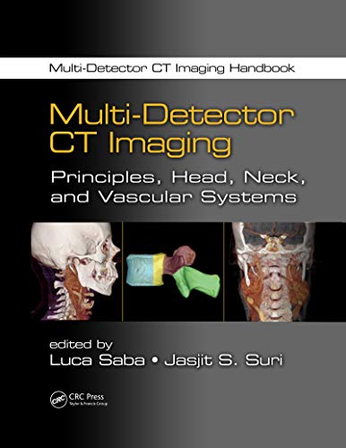 Multi-Detector CT Imaging: Principles, Head, Neck, and Vascular Systems (Multi-Detector CT Imaging Handbook) (English Edition)