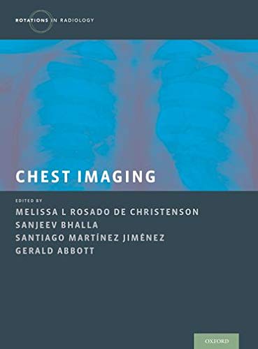 Chest Imaging (Rotations in Radiology)