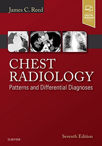 Chest Radiology: Patterns and Differential Diagnoses, 7e