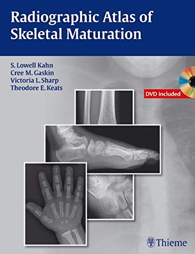 Radiographic Atlas of Skeletal Maturation