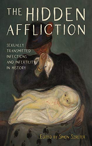 The Hidden Affliction: Sexually Transmitted Infections and Infertility in History: VOLUME 46 (Rochester Studies in Medical History, 46)