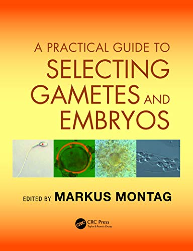 A Practical Guide to Selecting Gametes and Embryos (English Edition)