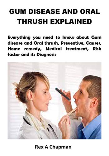 GUM DISEASE AND ORAL THRUSH EXPLAINED: Everything you need to know about Gum disease and Oral thrush, Preventive, Causes, Home remedy, Medical treatment, ... factor and its Diagnosis (English Edition)