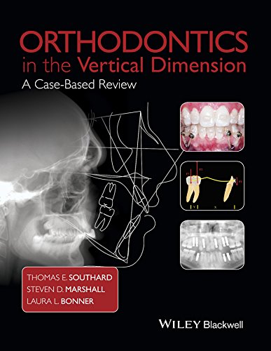 Orthodontics in the Vertical Dimension: A Case-Based Review (English Edition)