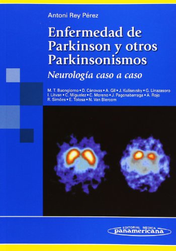 REY:Parkinson.Neurologa. Caso a caso: Neurología caso a caso