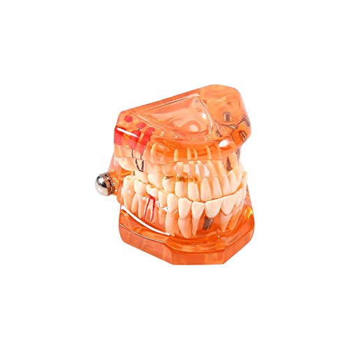 Ccylez Modelo de Dientes de enseñanza, Modelo estándar de Cristal Transparente Naranja, Modelo de Dientes Transparentes, Modelo de enseñanza de Estudio de Dientes