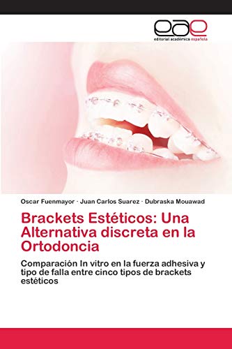 Brackets Estéticos: Una Alternativa discreta en la Ortodoncia