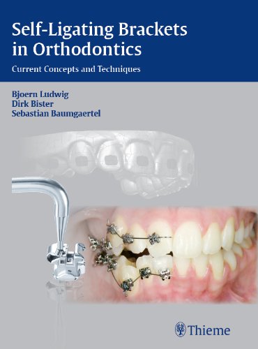 Self-ligating Brackets in Orthodontics: Current Concepts and Techniques (Advances in Applied Mathematics) (English Edition)