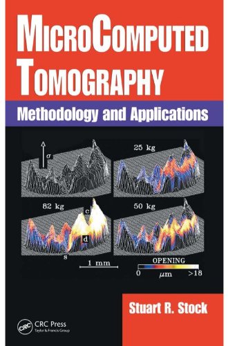 MicroComputed Tomography: Methodology and Applications (English Edition)